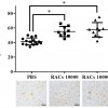 Intravenous Regeneration-associated Cell Transplantation Enhances Tissue Recovery in Mice with Acute Ischemic Stroke [Published online Keio J Med, 74, 79-85, by J-STAGE]