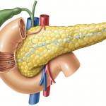 Pancreatic Cancer in Hereditary Breast and Ovarian Cancer Syndrome: Is Early Detection Possible? [Published online Keio J Med, 74, 146-150, by J-STAGE]